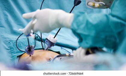 General & Laparoscopic Surgery Doctors In Silchar