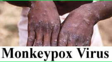 Monkeypox Virus क्या है और इसके Symptoms – पूरी जानकारी ले यह वायरस कैसे फ़ैल रहा है
